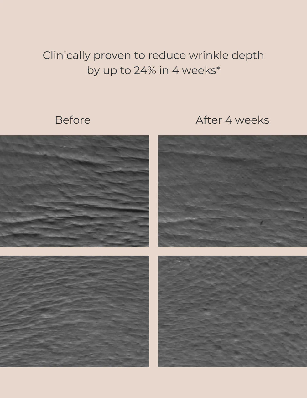 INIKA Organic Bakuchiol Serum Natural Retinol Alternative